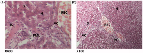 Figure 4. (HAREX 200 mg/kg + paracetamol) Histologic section through the liver at magnification ×400 (a) and ×100 (b) shows numerous polymorphonuclear aggregation, inflammation and congestion of the vessels and numerous hepatocytes and cellular proliferation. Conclusion: Moderately affected. S – sinusoidal layer; RBC – red blood cell; H – hepatocytes; VC – vascular congestion; IS – interlobular septum; PML – polymorphonuclear leucocytes; PT – portal triad.