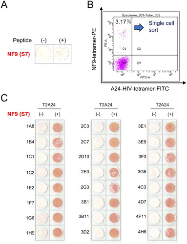 Figure 2. Establishment of NF9-specific CTL clone. (A) IFNγ ELISpot assay. PBMCs were evaluated for peptide specificity by an IFNγ ELISpot assay using NF9-peptide-pulsed T2-A24 cells as targets. Peptide-unpulsed T2-A24 cells served as a negative control. (B) FACS analysis using NF9 tetramer. PBMCs were stained with the HLA-A24 NF9 complex tetramer and analyzed by flow cytometry. The HLA-A24 HIV peptide complex tetramer was used as a negative control. NF9 tetramer-positive cells were sorted individually. (C) IFNγ ELISpot assay. Tetramer-positive clone cells were evaluated by an IFNγ ELISpot assay using NF9-peptide-pulsed T2-A24 cells as targets. Peptide-unpulsed T2-A24 cells served as a negative control.