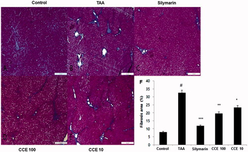 Figure 6. Masson’s trichrome staining of liver tissues. This stain was performed like H&E staining. Control (A), TAA (200 mg/kg): TAA-induced liver fibrosis rats (B), silymarin (50 mg/mL) (C), CCE 100 (D), CCE 10 (E) and fibrosis area plot (F). Scale bar = 200 μM. Quantification was done using ImageJ. Values are represented as mean ± S.E.M. (n = 10) using one-way analysis of variance (ANOVA) followed by Student’s t-test. #p < 0.05 as compared with control group, *p < 0.05, **p < 0.01 and ***p < 0.001 as compared with TAA group. TAA: thioacetamide-induced liver fibrosis rats, silymarin: positive control rats, CCE 100: CCE 100 mg/kg treated rats and CCE 10: CCE 10 mg/kg treated rats.