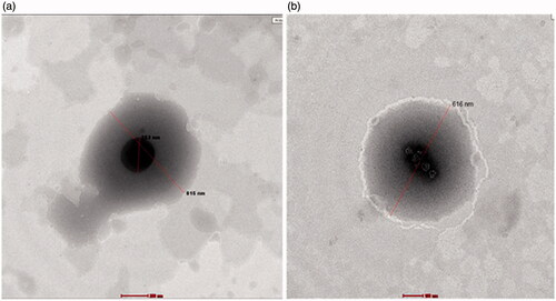Figure 5. TEM images for aAZD-loaded penetration enhancing hybridized vesicles (a) F1 and (b) F7.