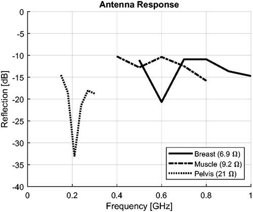 Figure 4. Reflection coefficients of the antenna models calculated at their (real) radiation impedance. The impedance is shown in the legend.