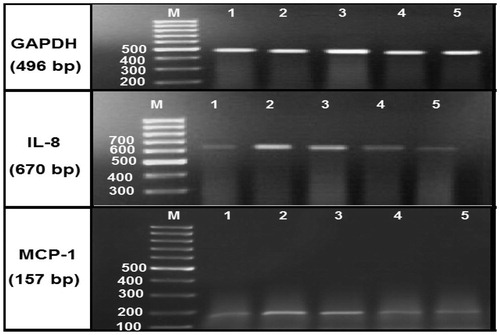 Figure 2. Agarose gel electrophoresis showing GAPDH, IL-8 and MCP-1 mRNA expression in the kidney tissues by RT-PCR analysis. Lane (1): represents the control group and lane (2): represents diabetic group. Lane (3): represents diabetic nephropathy group, and lanes (4): represents diabetic group treated with MSCs, whereas lanes (5): represents diabetic nephropathy group treated with MSCs. Lane M: represents DNA ladder (100 bp).