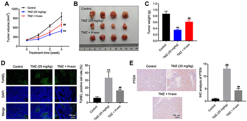 Figure 6 Exosomes derived from hypoxic glioma cells reduced TMZ sensitivity in glioma cells in vivo. (A) The tumor volume of mice was calculated. (B) The tumor tissues of mice were collected and pictured. (C) The tumor weight of mice was recorded. (D) The cell apoptosis of tumor tissues in mice was detected by TUNEL staining. (E) The level of PTEN in tumor tissues of mice was investigated by IHC staining. **P< 0.01 compared to control. ##P< 0.01 compared to TMZ.
