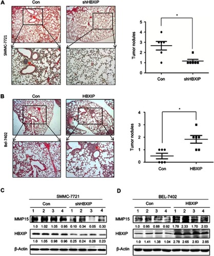 Figure 5 HBXIP facilitates the metastasis of HCC cells in vivo. (A) Representative image and statistical data of lung metastases in mice injected with control and HBXIP knockdown SMMC-7721 cells was shown. The arrow indicates the pulmonary metastasis node. (B) Representative image and statistical data of lung metastases in mice injected with control and HBXIP overexpressing Bel-7402 cells was shown. The arrow indicates the pulmonary metastasis node. The MMP15 and HBXIP protein levels in xenografts from control and HBXIP knockdown SMMC-7721 cells were examined by western blot. (C) The MMP15 and HBXIP protein levels in xenografts from control and HBXIP overexpressing Bel-7402 cells were examined by western blot. *P<0.05.Abbreviations: HCC, hepatocellular carcinoma; HBXIP, hepatitis B virus X-interacting protein.