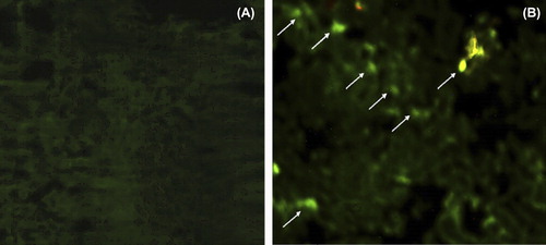 Figure 7. Fluorescence photograph of mice peyer's patch. (A). Mice treated with FITC-BSA solution; (B). Mice treated with A-CHMps loaded with FITC–BSA. Hot-Spot indicated by arrows showing the uptake of A-CHMps by peyer's patch of mice.