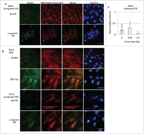 Figure 6. Immunofluorescent staining for parkin. (A) Images of parkin staining in NSCs (B) Localization of parkin in unirradiated (control) TIG-3 cells and TIG-3 cells irradiated with 5 Gy. DNA was stained with Hoechst. The scale bar represents 50 µm. (B) Percentage of parkin-positive NSCs exposed to FR at doses of 0.01 or 0.05 Gy/fraction.