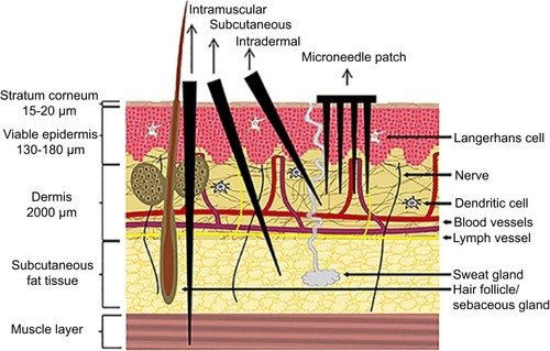 Figure 2 A schematic representation of the skin structure illustrating the different routes of administration, namely intramuscular, subcutaneous and ID injections. DMN penetrate the skin’s stratum corneum barrier reaching the viable epidermis, whereas the hypodermic needle punctures the skin into the subcutaneous and muscle tissue. Reproduced from Leone M, Mönkäre J, Bouwstra JA, Kersten GF. Dissolving Microneedle Patches for Dermal Vaccination. Pharm Res. 2017;34(11):2223-2240. Creative commons license and disclaimer available from: http://creativecommons.org/licenses/by/4.0/legalcode.Citation106