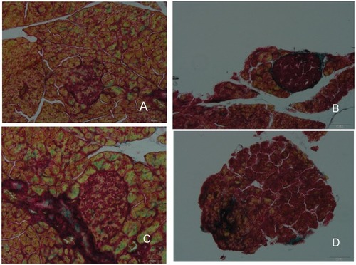 Figure 7 Histopathological changes in islet fibrosis in db/db mice. The diabetic control group showed evidence of severe damage characterized by the degranulation of β-cells and islet fibrosis (B), whereas the normal control group exhibited islets with typical histological structure in the pancreas (A). The administration of Met and DHM prevented islet fibrosis (C and D).