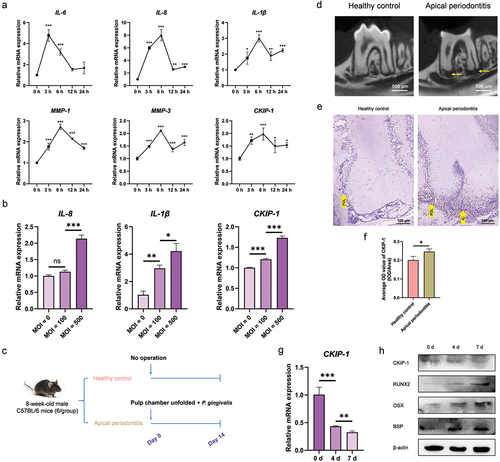 Figure 2. CKIP-1 increases in inflammation, and decreases during the osteogenic/cementogenic differentiation of PDLCs. The change role of CKIP-1 in inflammatory PDLCs stimulated with Pg was detected in vitro. (a) PDLCs were incubated with Pg at a MOI of 500 for 0, 3, 6, 12, 24 hours, and mRNA expressions of IL-6, IL-8, IL-1β, MMP-1, MMP-3, CKIP-1 were measured by RT-qPCR. (b) PDLCs were cultured with Pg at MOIs of 0, 100, 500 for 6 hours, and mRNA expressions of IL-8, IL-1β, CKIP-1 were detected by RT-qPCR. The change role of CKIP-1 in inflammatory PDL of AP model was also evaluated in vivo. (c) Schematic diagram of the mouse AP model. (d) Validation of the AP model by micro-CT. (e, f) the CKIP-1 expression and inflammation in the PDL area of AP model were confirmed by IHC and H&E staining. PDLCs were induced for 0, 4, 7 days, the expression of CKIP-1 during the osteogenic/cementogenic differentiation of PDLCs was detected by RT-qPCR (g) and western blotting (h). IL-(6, 8, 1β), interleukin-(6, 8, 1β); MMP-(1, 3), matrix metalloproteinase-(1, 3); CKIP-1, casein kinase-2 interaction protein-1; AP: apical periodontitis; IHC: immunohistochemistry; H&E: hematoxylin and eosin; PDL: periodontal ligament; IC: inflammatory cell. Yellow arrows indicate areas of bone resorption. Significance was defined as *P < 0.05, **P < 0.01 and ***P < 0.001. P > 0.05 was considered not significant (ns).