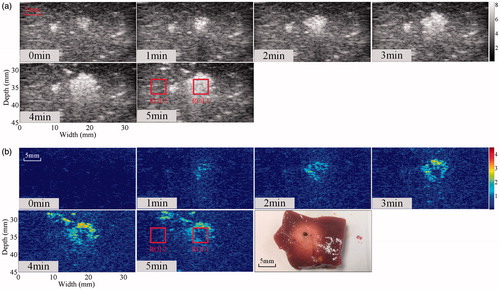 Figure 11. Temporal evolution of ultrasonic (a) B-mode and (b) Δα0 images of MWA-induced thermal lesion in an in vivo porcine liver during MWA treatment. The regions of interest (ROI) are the MWA-induced thermal lesion and surrounding normal tissue. Both regions of interest are 4 × 4 mm.