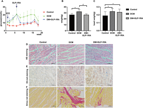 Figure 1 GLP-1RA reduces blood glucose levels, attenuates lipid accumulation and improves myocardial fibrosis in DCM mice. Eight-week-old male C57BL/6J mice were randomly divided into two groups: control group fed with a normal chow diet (n = 12) and DM group fed with a high-fat diet (n = 24). After 4 weeks of dietary intervention, DM group received an intraperitoneal injection of STZ at a dose of 100 mg/kg. T2DM of mice was diagnosed when the fasting blood glucose level was >11.1 mmol/L by two independent tests. After the next six weeks, the DM group was then randomly divided into two subgroups. GLP-1RA group (n = 12) received exenatide-loaded microspheres injection intraperitoneally once per week, while DCM group (n = 12) underwent intraperitoneal injection of normal saline. The high-fat diet was continued in DCM group and GLP-1RA group for the next 12 weeks. (A) Blood glucose of mice; (n = 12). (B) Body weight (n = 12). (C) Heart weight of mice (n = 12). (D) H&E staining on the heart sections of mice (n = 3). (E) Oil red staining on the heart sections of mice (n = 3). (F) Sirius red staining on the heart sections of mice (n = 3). Data are expressed as mean ± SD, *P <0.05 compared with control group; #P <0.05 compared with DCM group.