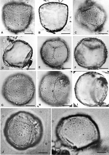 Figure 1. Spores of Hymenophyllum and Trichomanes under LM. A–D. Spores of Hymenophyllum tunbridgense var. cordobense. A, B. Spores in superficial view and optical section respectively: A. The ornamentation is formed of low, scattered elements with circular outline. The laesurae have thick margins and reach the equator; B. The spore has a subtriangular outline. C, D. Spores in superficial, equatorial views and in optical section respectively; observe in (D) the proximal shape conic and the distal shape convex. E–K. Spores of Trichomanes reptans. E, F. Proximal views, in surface and optical section respectively: E. Low scattered elements with circular outline are visible. The laesurae are marked and are ¾ of the spore radius; F. The optical section allows to appreciate the circular outline. G. Distal view, with low scattered elements. H. Atypical spore with a circular laesura. I. The same spore as in (H), in optical section. J, K. Proximal, superficial and equatorial views, respectively: J. The elements of the ornamentation are scattered and occasionally fused by their bases forming short, low and narrow ridges. The laesurae are well marked; K. The spore is proximally convex and distally hemispheric. Scale bars – 10 μm.