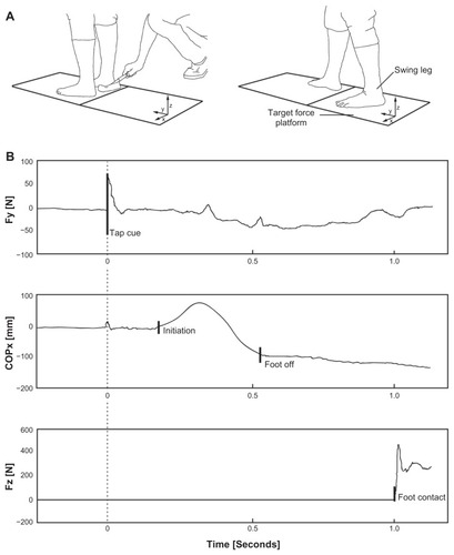 Figure 2 Voluntary step execution test: (A) participant standing on the force platform and executing a backward step after tap cue on the heel by the supervisor; (B) example of force platform data for a single step to determine the occurrence of the step parameters.