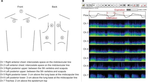 Figure 1 (A) Seven lung sound recording positions; (B) lung sound analysis sonograms.