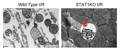 Figure 2. Hearts from STAT1−/− mice and wild type litter mate controls were subjected to ex vivo I/R injury using Langendorff perfusion and then sections subjected to electron microscopy. It was found that cells from STAT1−/− mice had increased numbers of mitochondria (red arrow) located within double membrane structures suggesting they had an increased rate of autophagy.