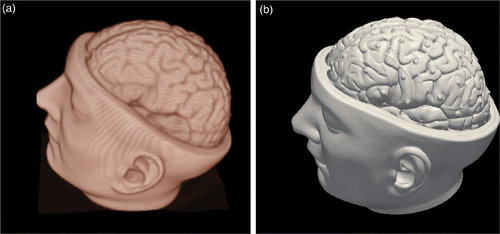 Figure 2. (a) Volume-rendered phantom brain CT image and (b) surface-rendered brain model.