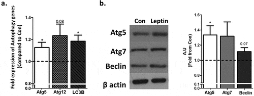 Figure 3. Leptin increases the expression of selected autophagy genes and proteins in adipocytes. Differentiated murine adipocytes were treated with leptin (100ng/ml) for 24h. (a) Autophagy related gene expression measured by RT-PCR, normalized to RPLP0 and HPRT. Results (n = 4 independent experiments) are the mean+SEM fold expression from control. (b) Representative Western blots of autophagy related proteins normalized to β actin. Results in the graph are the mean+SEM densitometry values of four independent experiments. *p < 0.05.