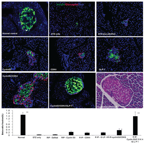 Figure 1 Triple staining for pancreas tissue at magnification of 200x. Anti-insulin (green), Anti-glucagon (red), and anti-nuclear (blue) antibodies were used. Upper left: normal pancreatic islet; Upper middle: STZ treated; Upper right: STZ plus RIP-DsRed; Middle left: RIP-cyclin D2 treated; Middle center: RIP-CDK4 treated; Middle right: RIP-GLP1 treated; Lower left: RIP-cyclin D2/CDK4 treated; Lower center: RIP-cyclin D2/CDK4/GLP1 treated; Lower right: H&E staining for similar slide of RIP-cyclin D2/CDK4/GLP1. Figure at the bottom is the β cell fraction, *p < 0.05; **p < 0.001 vs. STZ control; n = 6 animals, Error bars represent mean ± SEM, N values are numbers of pancreas analyzed for each group, all animals killed at 4 weeks after UTMD.