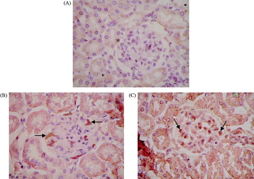 Figure 4. Expression of MCP-1 and TGF-β1 detected by immunohistochemical staining. (A) Negative controls for immunohistochemical staining. IHC ×400. (B) Expression of MCP-1 in positive cells of renal tissue. (C) Expression of TGF-β1 in positive cells of renal tissue. IHC ×400. Black arrows indicate cells exhibiting positive expression in glomeruli.