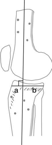 Figure 5. The relative anteroposterior position of the tibia was measured on the lateral view of the reference position. The reconstructed central femoral line divided the tibia into one anterior (distance a) and one posterior (distance b) part. The quotient a/a+b x 100 was computed.