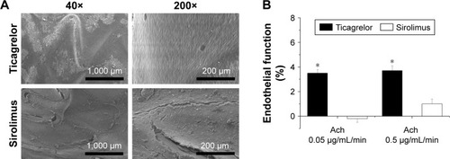 Figure 5 (A) SEM images of endothelial coverage and (B) acetylcystine infusion for endothelial function test (40×: scale bar = 1,000 µm; 200×: scale bar = 200 µm).Note: *P<0.001.Abbreviations: Ach, acetylcholine; SEM, scanning electron microscope.