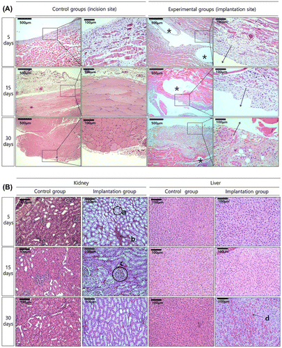 Figure 5. HE stained histological images of (A) the tissue attached to the specimen (The direction of the arrows is the implantation site, and gas pockets mark as asterisk, *), and (B) the kidney and liver tissues after implantation.