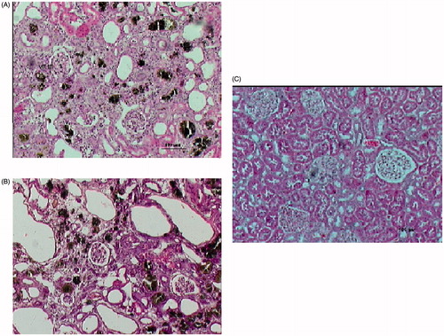Figure 2. (A) Interstitial inflammatory changes consisting mainly of fibrosis, adenine crystals and tubular atrophy in the kidney cortex of a rat from group A sacrificed after 4 weeks on the adenine diet and stained with hematoxylin-eosin. (B) More prominent interstitial fibrosis, adenine crystals and tubular changes with scant inflammation in the kidney cortex of a rat from group A sacrificed after 8 weeks and stained with hematoxylin-eosin. (C) Normal kidney cortex of a rat from group B after 8 weeks on a regular diet stained with hematoxylin-eosin.