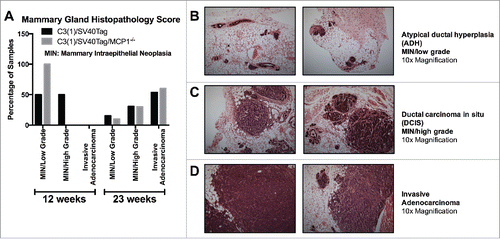 Figure 3. Mammary gland histopathology for each treatment group. (A) Graph of mammary gland pathology score for mice at 12 weeks and 23 weeks of age for both groups. (B) Representative images of atypical ductal hyperplasia (ADH, low grade MIN lesion) characterized by several layers of disarranged atypical epithelial cells with frequent mitotic figures. (C) Representative images of ductal carcinoma in situ (DCIS, high grade MIN lesion) characterized by filling and expansion of ducts with dysplastic epithelial cells without breach of the basement membrane or invasion of the surrounding adipose tissue. (D) Representative images of invasive adenocarcinoma characterized by pleomorphic neoplastic cells arranged in sheets or in tubules separated by fine fibrovascular stroma. Figs. B–D shown at 10x magnification. Data are represented as percentage of total samples for each time point/group, 12 week time point: C3(1)/SV40Tag n = 6, C3(1)/SV40Tag/MCP-1−/− n = 6, 23 week time point: C3(1)/SV40Tag n = 15, C3(1)/SV40Tag/MCP-1−/− n = 12.