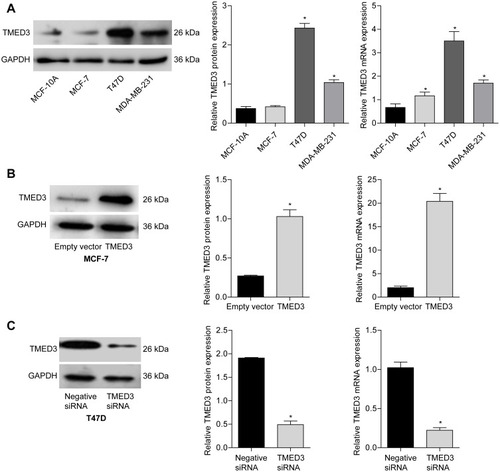 Figure 4 Expression of TMED3 mRNA and protein in a normal breast epithelial cell lines and several breast cancer cell lines.Notes: (A) qPCR and Western blot analysis showing the expression of TMED3 protein and mRNA in normal breast epithelial cells (MCF-10A) and three breast cancer cell lines (MCF-7, T47D, MDA-MB-231). (B) Transfection with TMED3 plasmid increased the expression of TMED3 mRNA and protein compared to empty vector in MCF-7 cells. (C) Transfection with TMED3 siRNA decreased the expression of TMED3 mRNA and protein compared to negative siRNA in T47D cells. *P<0.05.