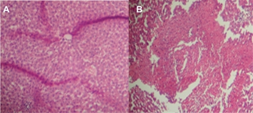 Figure 5 Liver tissue damage due to injection of acetaminophen at two different concentrations. A) shows little damage due to acetaminophen nanodrug injection and B) shows normal drug injection.Citation69
