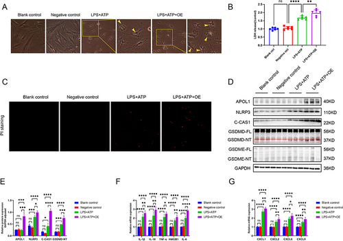 Figure 6 APOL1 overexpression can induce pyroptosis in fibroblasts. This part was divided into four groups, Blank control group, Negative control group (empty plasmid group), LPS+ATP group, LPS+ATP+OE (overexpression plasmid) group, respectively. LPS+ATP were used to induce cell pyroptosis, and APOL1 gene overexpression plasmid was constructed. (A and B) Fibroblasts were induced to pyroptosis, then the morphological changes in cells (A) LDH release (B). Scale bars: 200 mm. Yellow arrows, pyroptotic bubbles. (C) Fibroblasts were stained with PI (100 µL/well). (D) The protein expression was detected by Western blot. (E) Relative protein expression of GAPDH adjusted. (F) The mRNA levels of infammatory factors including IL-1β, IL-18, TNF-α, HMGB1, and IL-6 were detected by RT-PCR. (G) The mRNA levels of chemokines including CXCL1, CXCL2, CXCL9, and CXCL10 were detected by RT-PCR. *p<0.05, **p<0.01, ***p<0.001, and ****p<0.0001.