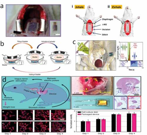 Figure 8. TENG-powered implantable devices in the body. TENG used to detect changes in lung (a), bladder (b, c), stomach (d), and joint surface [Citation54,Citation55,Citation56,Citation10]
