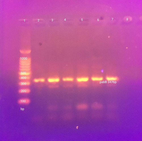 Figure 2 Screening of pabB gene for O25-ST131 in E. coli isolates. Lane 1, 100 bp molecular marker (iNtRON Biotechnology, South Korea); Lane 2–6 show (pabB gene) 347 bp; Lane 7 (positive control); Lane 8 (negative control).