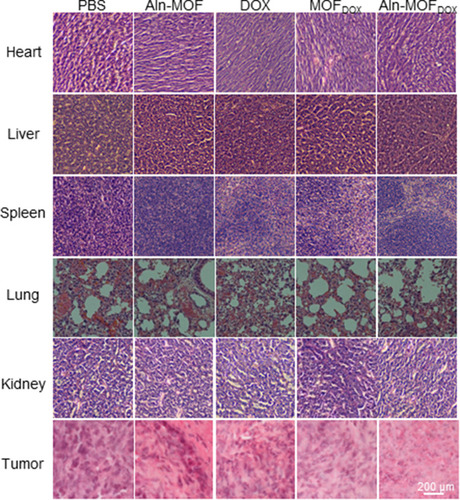 Figure 10 HE staining of different tissues containing heart, liver, spleen, lung, kidney and tumor (bone metastases) on day 18.