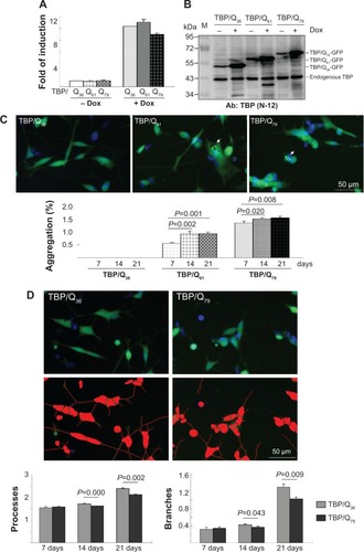 Figure 3 SH-SY5Y cells with induced TBP/Q36~79-GFP expression and neuronal phenotype.