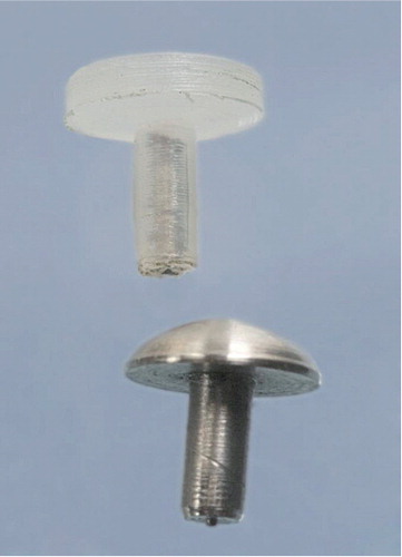Figure 1. Non-constrained knee prosthesis.