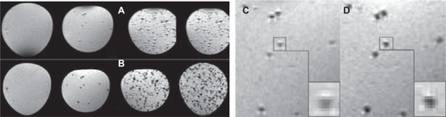 Figure 8 MR images of nano iron particle-labeled single cells in the MSME (A, C) and 2D-FLASH (B, D) sequences. The 2D-FLASH sequence was more sensitive than the MSME sequence under conditions of identical slice thickness and resolving power.Abbreviations: 2D-FLASH, gradient echo sequence; MR, magnetic resonance; MSME, multislice, multiecho.
