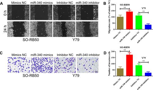 Figure 4 miR-340 enhances the migration and invasion capacity of retinoblastoma cells. (A and B) Wound healing assays results showed that miR-340 mimics promoted migration of SO-RB50 cells, while miR-340 inhibitor suppressed migration of Y79 cells compared with negative control. (C and D) Transwell invasion assays results showed that miR-340 overexpression increased the number of invasive SO-RB50 cells, but miR-340 knockdown decreased the number of invasive Y79 cells compared with negative control. **P<0.01. Scale bars, 100 μm.