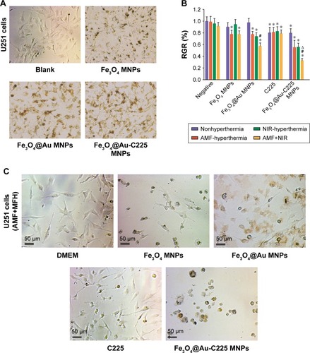 Figure 6 Proliferation of U251 cells after different treatments.Notes: (A) Fe3O4 MNPs, Fe3O4@Au MNPs, and Fe3O4@Au-C225 MNPs were incubated with U251 cells. (B) The cell RGR of U251 glioma cells with different treatments (x¯±S). (C) U251 cells were treated with combined hyperthermia (MFH+NIR) mediated by different nanoparticles. *Compared with the negative control group, P<0.05; #AMF+NIR group compared with AMF or NIR group, P<0.05; ∆Fe3O4@Au-C225 MNPs compared with Fe3O4@Au MNPs when exposed to AMF combined with NIR, P<0.05.Abbreviations: AMF, alternating magnetic field; C225, cetuximab; DMEM, Dulbecco’s Modified Eagle’s Medium; MFH, magnetic fluid hyperthermia; MNPs, magnetic nanoparticles; NIR, near-infrared hyperthermia; RGR, relative growth rate.