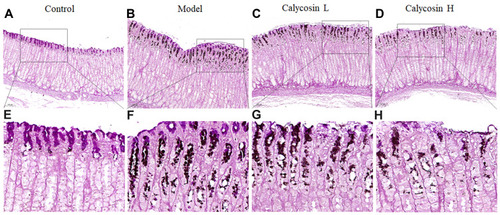 Figure 5 Effects of calycosin on histopathological changes in gastric mucosa tissue of PLGC rats. (A and E) Histopathological changes of gastric mucosa in the control group (HID-AB-PAS staining, 10×, 40×). (B and F) Histopathological changes of gastric mucosa in the model group (HID-AB-PAS staining, 10×, 40×). (C and G) Histopathological changes of gastric mucosa in the calycosin low group (HID-AB-PAS staining, 10×, 40×). (D and H) Histopathological changes of gastric mucosa in the calycosin high group (HID-AB-PAS staining, 10×, 40×).