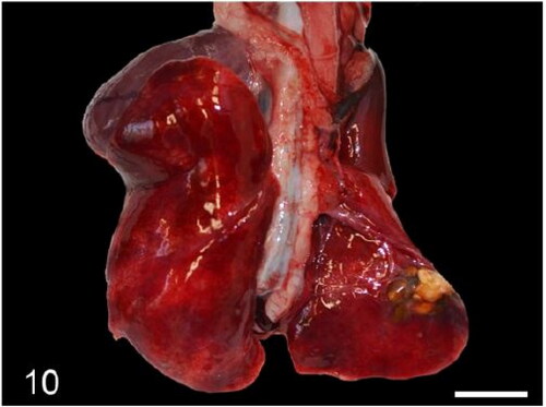 Figure 10. Case 8. Focal pulmonary cholesterol granuloma. Bars = 1 cm.