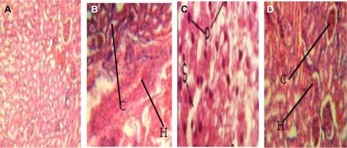 Figure 2 Pathogenic effects of Enterococcus faecalis strains on experimental animals (magnification 400×). (A) Liver tissue of albino rat (control group) showing normal tissue appearance. (B) Liver tissue of albino rat, fed with EFC 12 (having four virulence genes gel+, esp+, cylA+, and asa1+) showing pronounced renal corpuscles and areas of inflammatory changes (arrow). (C) Liver tissue of albino rat fed with EFT 148 (having three virulence genes gel+, ace+, and asa1+) showing necrosis of hepatic cells with pyknotic nuclei, disorganization of hepatic laminae, and dilation of sinusoids (arrow). (D) Liver tissue of albino rats, fed strain of E. faecalis strain EFS 18 (having two virulence genes, ie, gel−, esp+, and cylA+) showing well preserved renal corpuscles and less pronounced areas of inflammatory changes (arrow).
