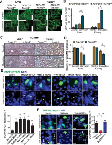 Figure 7. TMBIM6 increases autophagy flux under starvation conditions in vivo. (A-B) GFP-LC3 puncta formation was analyzed in the liver or kidney (A) of nutrient-starved GFP-LC3/Tmbim6+/+ and GFP-LC3/tmbim6−/- mice after 24 h (n = 5). GFP-LC3 puncta formation was quantified (B). Scale bar: 100 μm. The data are represented as the mean ± SEM from n = 5 per group. (C-D) Immunohistochemistry analysis of SQSTM1 was performed in the kidney and liver from control and 24-h starved Tmbim6+/+ and tmbim6−/- mice (C). The SQSTM1 expression levels were quantified (D). Scale bar: 100 μm. The data are represented as the mean ± SEM from n = 5 per group. (E) HT1080 cells were transfected with or without TMBIM6 or ITPR siRNA together with EGFP-HTTQ74 for 24 h. The percentage of cells with EGFP-positive aggregates is shown. Scale bar: 25 µm. (F) EGFP-HTTQ74 clearance was analyzed in transfected HT1080 cells vector, TMBIM6, and TMBIM6D213A cells. Scale bar: 25 µm. The data are represented as the mean ± SEM from n = 3 independent experiments