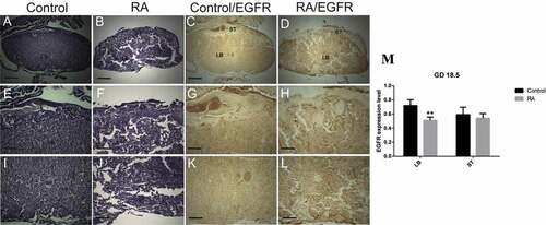 Figure 8. Photomicrographs of the transverse sections of the mice placentae on gestation day (GD) 18.5 from control (a, e, i, c, g, k) and RA treated (b, f, j, d, h, l) groups. (a, e, i) Histology of the placenta from the control group showing, reduction of the thickness of both decidual basalis (DB) and junctional zone (JZ), while the thickness of the labyrinth zone (LB) is increased comparing to the previous stage (GD13.5). (e) a magnified part of the spongiotrophoblast layer (ST). (i) a magnified part of labyrinth zone. (b, f, and j) Showing effect of RA treatment on placental development, note small size of the placenta with inhibition of the development of the labyrinth zones (Hx & E staining). (c, g, and k) illustrate the immunohistochemical localization of EGFR of the placenta from control group, note weak expression of EGFR in spongiotrophoblast layer, while in labyrinth zone the expression is strong. (d, h, l) showing the effect of RA on EGFR, the expression level of EGFR is moderate in spongiotrophoblast layer (ST), and labyrinth zone (LB). (m) Optical density of EGFR-positive areas in spongiotrophoblast layer (ST) and labyrinth zone (LB). Density is expressed as the number of positive areas. **P < 0.01 compared with the control group. Scale bar (a–d): 100 µm, (e–l): 50 µm.