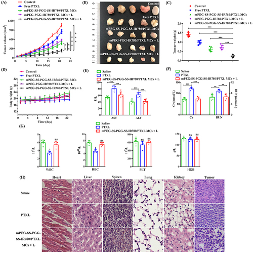 Figure 9 (A–D) Anti-tumor efficacy in LLC xenograft models: tumor growth, photographs of tumor tissues, tumor weight, and body weight profiles under different treatments. The mice were treated with various formulations by i.v. injection at a dose of 10 mg/kg PTXL (n = 5, **P < 0.01, ***P < 0.001). (E–G) Evaluation of AST, ALT, Cr, BUN, WBC, RBC, PLT, and HGB levels upon treatment with saline, PTXL, and mPEG-SS-PGG-SS-IR780/PTXL MCs + L (n = 5, *P < 0.05, **P < 0.01, ***P < 0.001). (H) Image of H&E assays in the heart, liver, spleen, lung, kidney, and tumor after treatment with various formulations over 21 days. Scale bars = 20 μm.