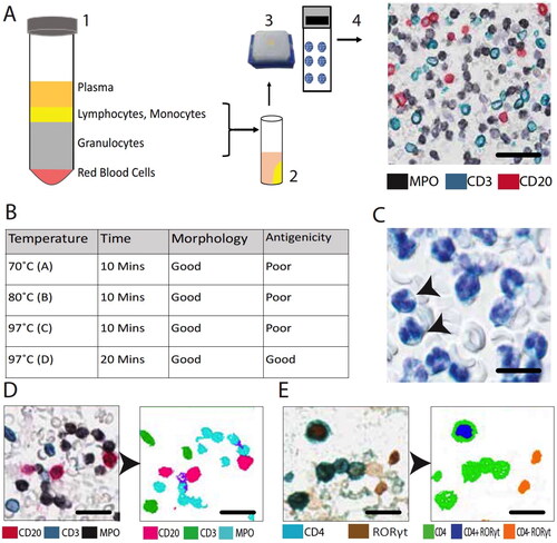 Figure 1. Schematic overview of blood leukocyte pellet preparation (A). After a brief pre-fixation, cells are separated by dextran sedimentation (1). Layers containing leukocytes are collected and white blood cells are spun down into pre-warmed melted agarose (2), which after being allowed to solidify and subjected to 4% formaldehyde fixation is embedded in paraffin (3) and cut into sections used for detection of multiple leukocyte markers by immunohistochemistry (4) (scale bar = 35 µm). Selection of optimal low pH heat-induced antigen retrieval conditions (B) and representative example of Htx-stained leukocytes amidst the few remaining erythrocytes (C) (scale bar = 10 µm). Example of detection and segmentation strategies for computerized quantitative image analysis (D,E) (D, scale bar = 25 µm; E, scale bar = 17 µm). In panel E, the brown RORγt-positive nuclei up to the left is touching CD4-immunoreactivity and is thus reclassified as a Th17 cell.