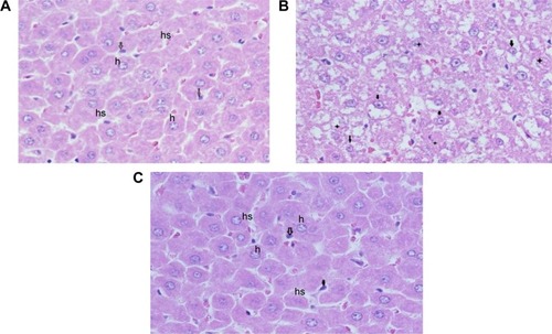 Figure 7 Photomicrographs of liver sections stained by H&E, 400×.Notes: (A) Control rat: showing the typical hepatic architecture of hepatocytes (h), hepatic sinusoids (hs) and Kupffer’s cells (arrows). (B) GNPs-treated rat: showing swollen hepatocytes with vacuolated cytoplasm (arrows), and other hepatocytes with necrosis (stars). (C) GNPs + melanin-treated rat: showing normal hepatocytes (h), hepatic sinusoids (hs), and Kupffer’s cells (arrows).Abbreviation: GNP, gold nanoparticle.
