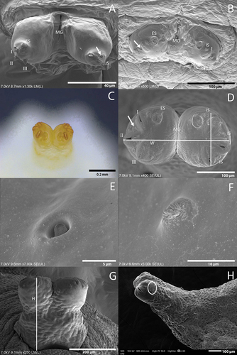 Figure 9. Posterior respiratory process (PRP) of Sphaerophoria species: A. S. rueppellii, L1 larva spiracular plated under SEM (I, II and III, carinae; ES, ecdysial scar; arrow, perispiracular gland; IS, short inter-spiracular setae; MG, median groove); B. S. rueppellii, L2 larva spiracular plated; C. S. rueppellii L3, spiracular plated under stereomicroscope; D. S. rueppellii, L3 larva, spiracular plated (W, width; L, length); E. S. rueppellii, perispiracular gland; F. S. rueppellii, short inter-spiracular setae; G. S. rueppellii, measurement of PRP (H, height); H. S. scripta (circle, position of wrinkles).