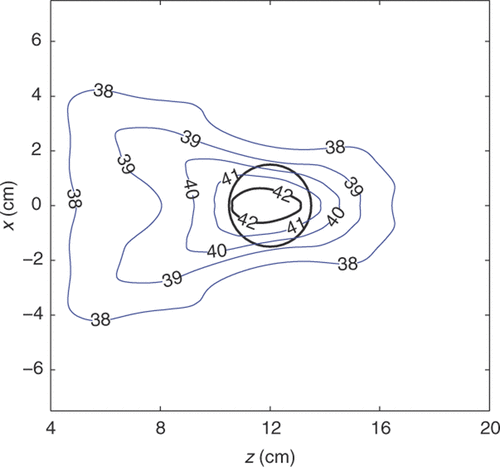 Figure 2. Simulated temperature (°C) in the y = 0 plane calculated in response to the power deposition obtained with waveform diversity and mode scanning before tumour control points are removed. The centre of the tumour model is located at z = 12 cm, and the 33 initial tumour control points are uniformly distributed throughout the 3 cm diameter tumour in quadrant I. The overall peak temperature in all bioheat transfer simulations is 43°C.