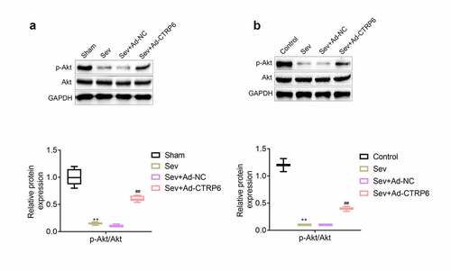 Figure 6. CTRP6 activated the expression of p-Akt in primary cells of central nervous tissue. (a, b) The expression levels of p-Akt and Akt in central nervous tissues and primary cells were measured with western blotting. #p< 0.05, **p< 0.01